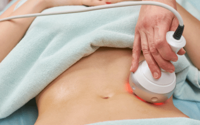 What to Know Before Your Body Sculpting Treatment in Snellville, GA